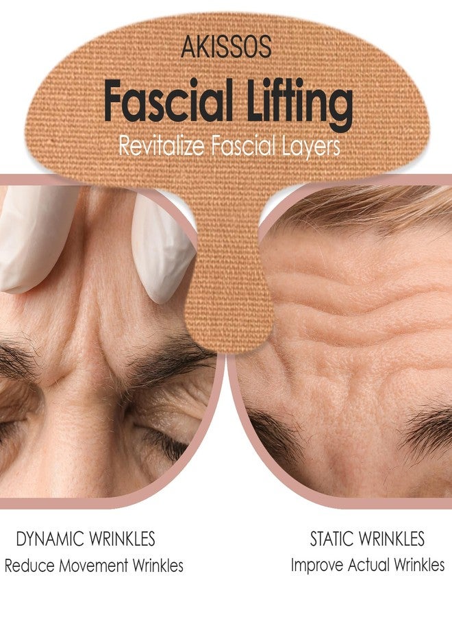 Akissos Forehead Wrinkle Patches Overnight (15 Pack) - Deep Wrinkle Repair from Fascia Layer,Micro Lift Elastic Facial Patches, Face Tape for Sleeping, Hypoallergenic Elasticity Cotton for Forehead Firming - Image 2